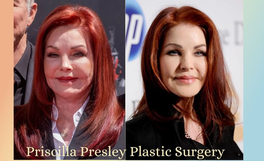 priscilla presley plastic surgery