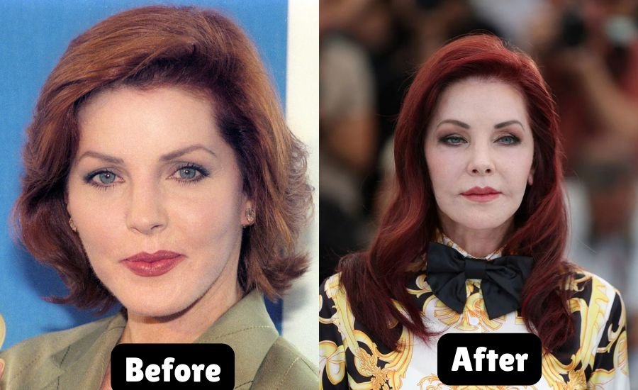 priscilla presley plastic surgery